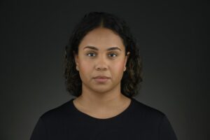 After Evolysse treatment - 2 weeks