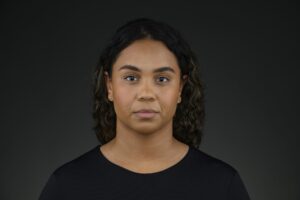 Before Evolysse treatment